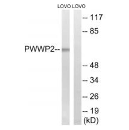 Western blot - PWWP2B Antibody from Signalway Antibody (34941) - Antibodies.com
