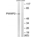 Western blot - PWWP2B Antibody from Signalway Antibody (34941) - Antibodies.com