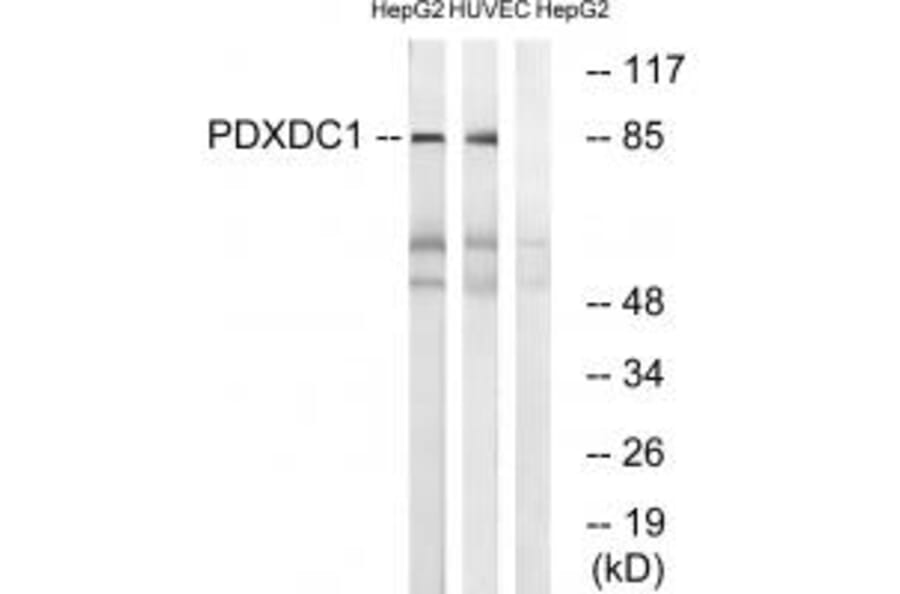 Western blot - PDXDC1 Antibody from Signalway Antibody (34942) - Antibodies.com