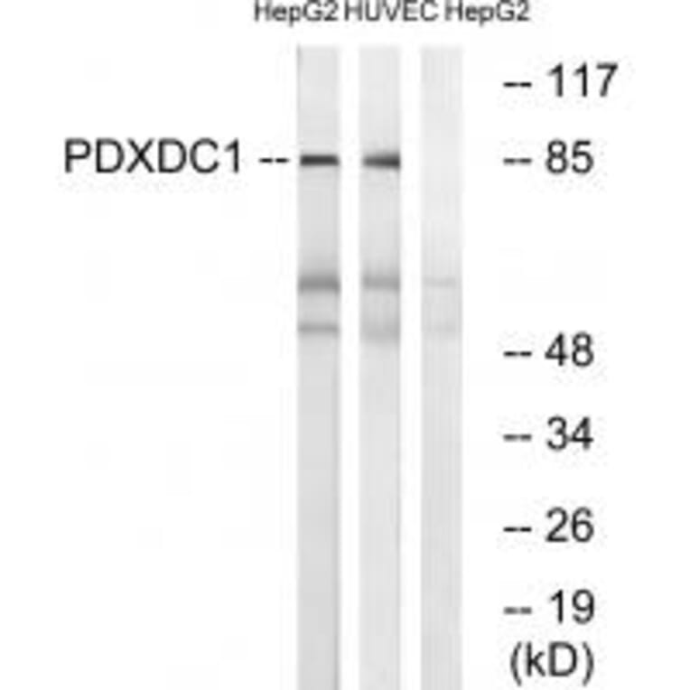 Western blot - PDXDC1 Antibody from Signalway Antibody (34942) - Antibodies.com