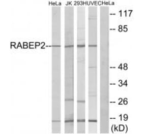 Western blot - RABEP2 Antibody from Signalway Antibody (34947) - Antibodies.com