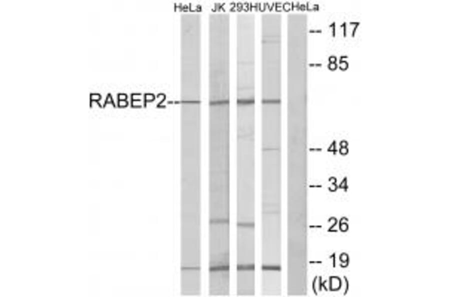 Western blot - RABEP2 Antibody from Signalway Antibody (34947) - Antibodies.com
