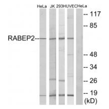 Western blot - RABEP2 Antibody from Signalway Antibody (34947) - Antibodies.com