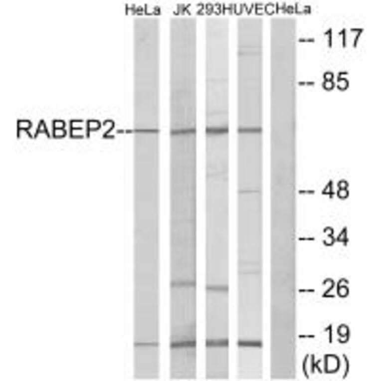 Western blot - RABEP2 Antibody from Signalway Antibody (34947) - Antibodies.com