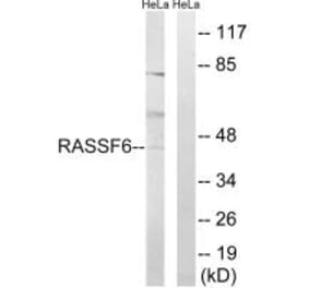 Western blot - RASSF6 Antibody from Signalway Antibody (34962) - Antibodies.com