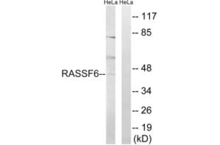 Western blot - RASSF6 Antibody from Signalway Antibody (34962) - Antibodies.com
