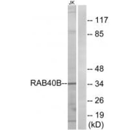 Western blot - RAB40B Antibody from Signalway Antibody (34970) - Antibodies.com