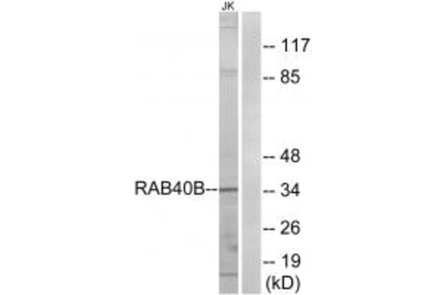 Western blot - RAB40B Antibody from Signalway Antibody (34970) - Antibodies.com
