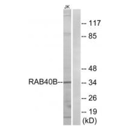 Western blot - RAB40B Antibody from Signalway Antibody (34970) - Antibodies.com