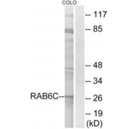 Western blot - RAB6C Antibody from Signalway Antibody (34973) - Antibodies.com
