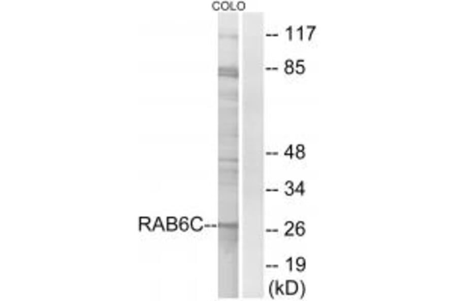 Western blot - RAB6C Antibody from Signalway Antibody (34973) - Antibodies.com