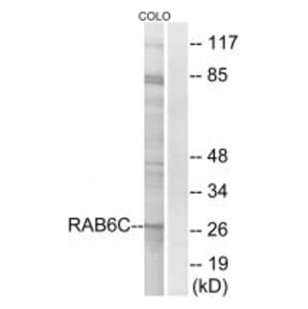 Western blot - RAB6C Antibody from Signalway Antibody (34973) - Antibodies.com