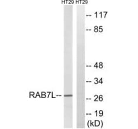 Western blot - RAB7L1 Antibody from Signalway Antibody (34974) - Antibodies.com