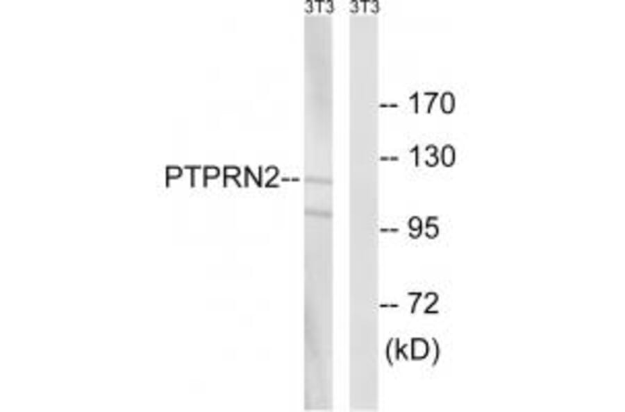 Western blot - PTPRN2 Antibody from Signalway Antibody (34976) - Antibodies.com