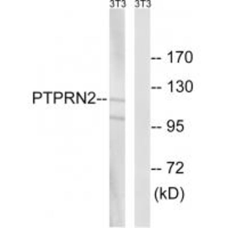 Western blot - PTPRN2 Antibody from Signalway Antibody (34976) - Antibodies.com