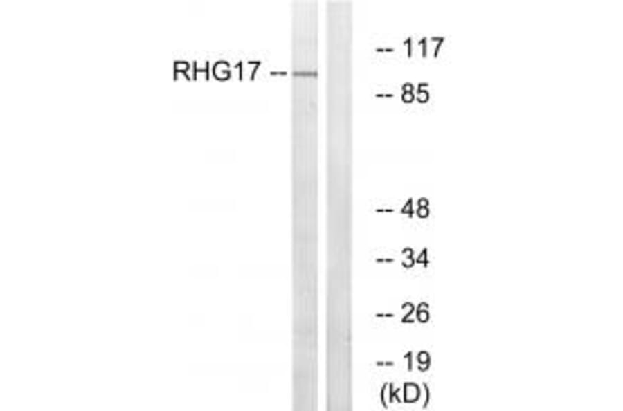 Western blot - RHG17 Antibody from Signalway Antibody (34988) - Antibodies.com