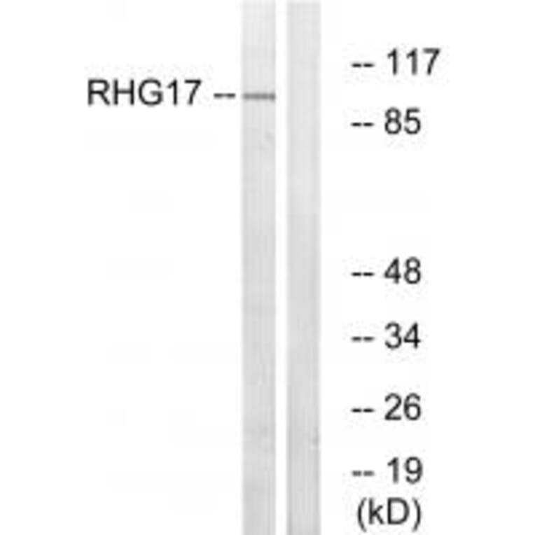 Western blot - RHG17 Antibody from Signalway Antibody (34988) - Antibodies.com