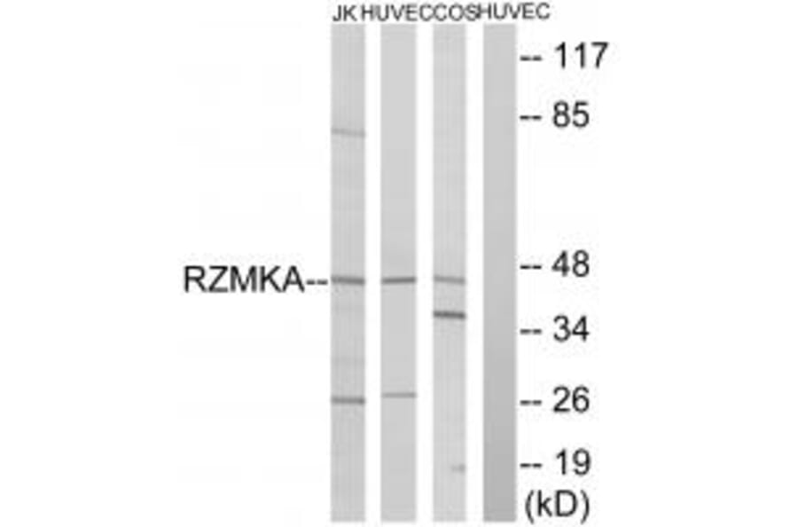 Western blot - RIMKA Antibody from Signalway Antibody (35001) - Antibodies.com