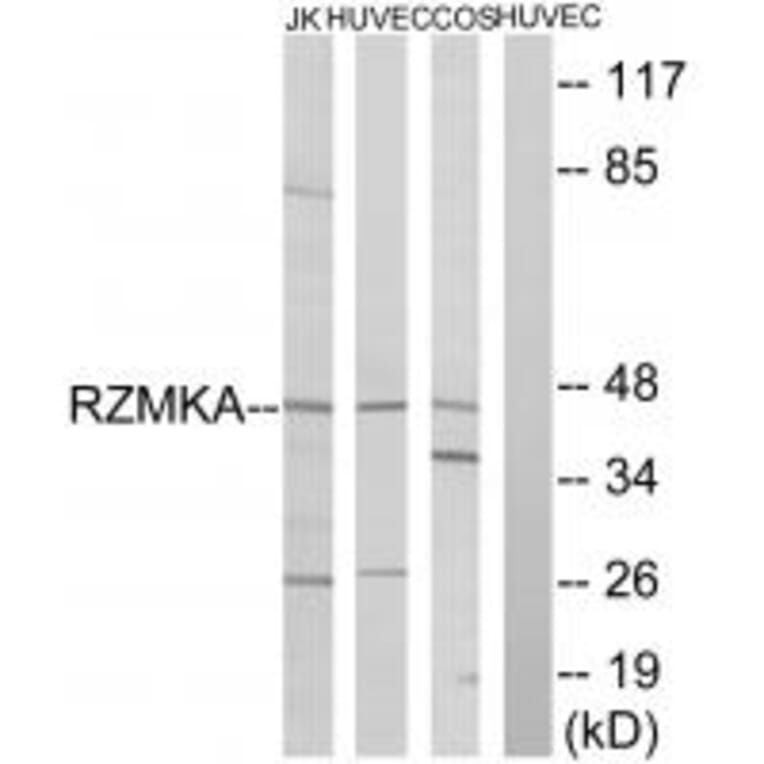 Western blot - RIMKA Antibody from Signalway Antibody (35001) - Antibodies.com