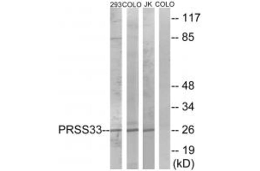 Western blot - PRSS33 Antibody from Signalway Antibody (35017) - Antibodies.com