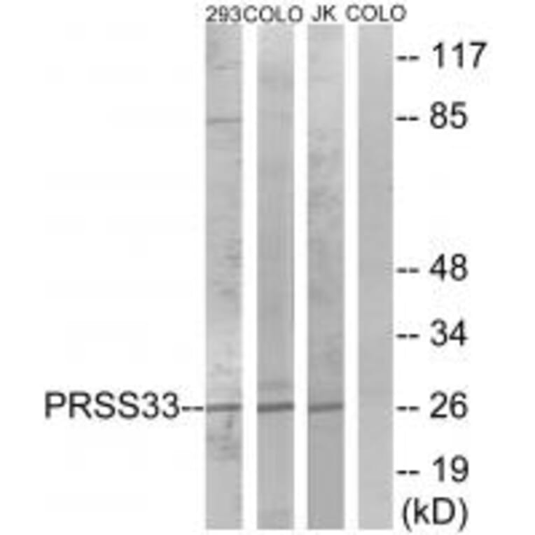 Western blot - PRSS33 Antibody from Signalway Antibody (35017) - Antibodies.com