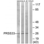 Western blot - PRSS33 Antibody from Signalway Antibody (35017) - Antibodies.com