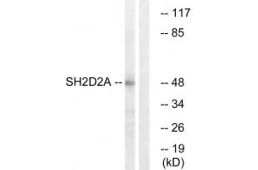Western blot - SH2D2A Antibody from Signalway Antibody (35041) - Antibodies.com