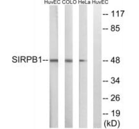 Western blot - SIRPB1 Antibody from Signalway Antibody (35049) - Antibodies.com
