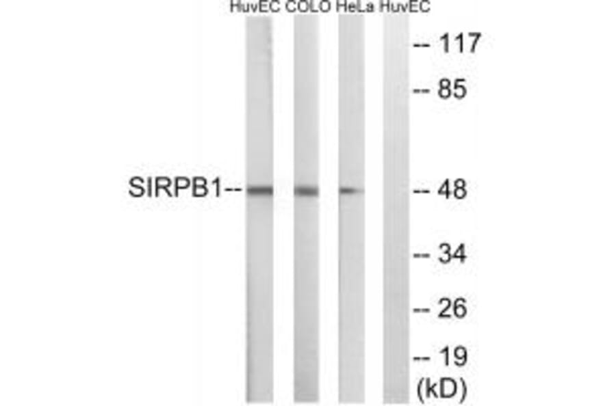 Western blot - SIRPB1 Antibody from Signalway Antibody (35049) - Antibodies.com