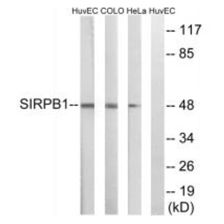 Western blot - SIRPB1 Antibody from Signalway Antibody (35049) - Antibodies.com