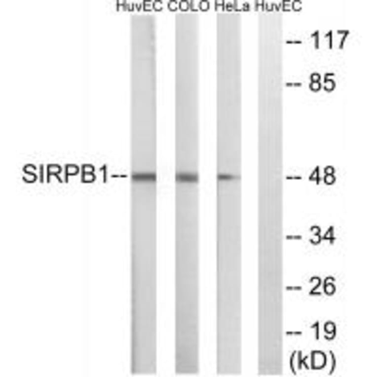 Western blot - SIRPB1 Antibody from Signalway Antibody (35049) - Antibodies.com