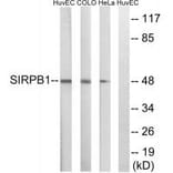 Western blot - SIRPB1 Antibody from Signalway Antibody (35049) - Antibodies.com