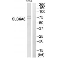 Western blot analysis of extracts from HuvEc cells, using SLC6A8 antibody #35050.