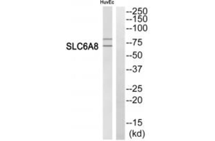 Western blot - SLC6A8 Antibody from Signalway Antibody (35050) - Antibodies.com