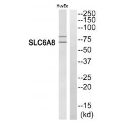 Western blot - SLC6A8 Antibody from Signalway Antibody (35050) - Antibodies.com