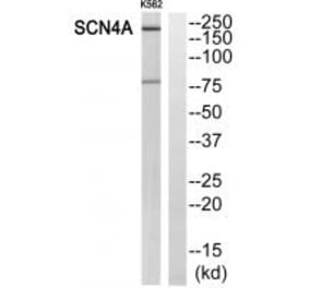 Western blot - SCN4A Antibody from Signalway Antibody (35054) - Antibodies.com