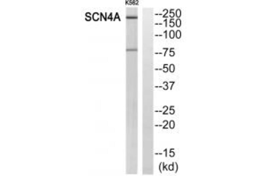 Western blot - SCN4A Antibody from Signalway Antibody (35054) - Antibodies.com