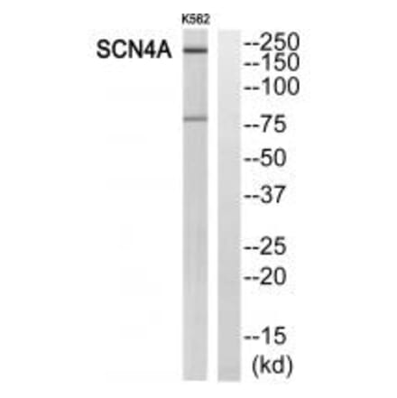 Western blot - SCN4A Antibody from Signalway Antibody (35054) - Antibodies.com