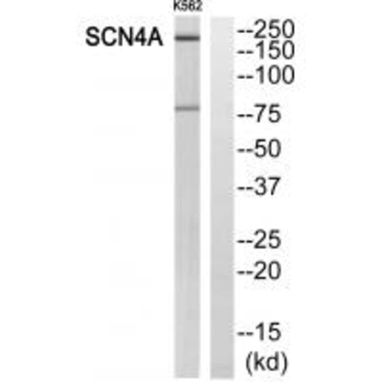 Western blot - SCN4A Antibody from Signalway Antibody (35054) - Antibodies.com