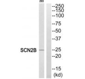 Western blot - SCN2B Antibody from Signalway Antibody (35057) - Antibodies.com