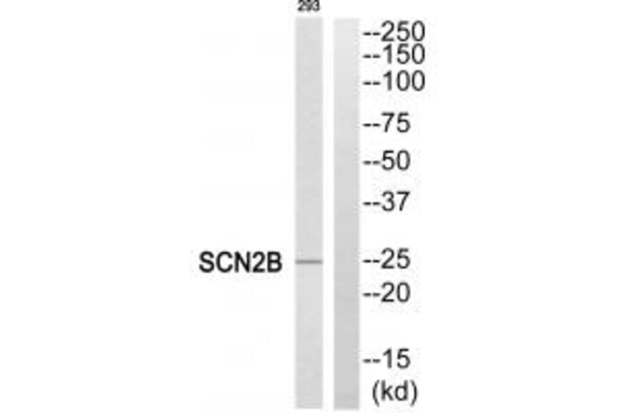 Western blot - SCN2B Antibody from Signalway Antibody (35057) - Antibodies.com