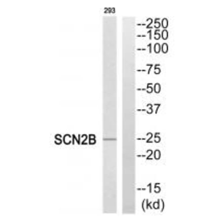 Western blot - SCN2B Antibody from Signalway Antibody (35057) - Antibodies.com