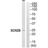 Western blot - SCN2B Antibody from Signalway Antibody (35057) - Antibodies.com