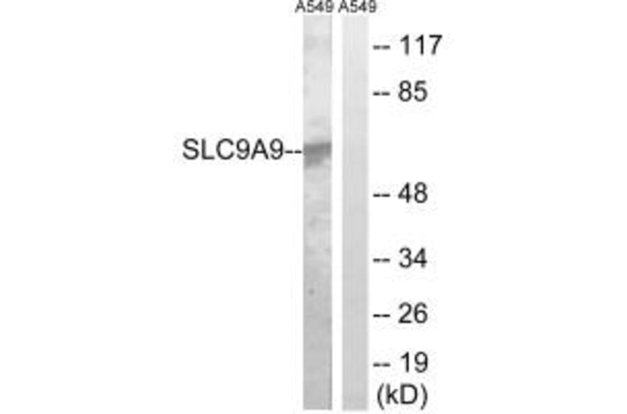 Western blot - SLC9A9 Antibody from Signalway Antibody (35060) - Antibodies.com