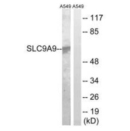 Western blot - SLC9A9 Antibody from Signalway Antibody (35060) - Antibodies.com