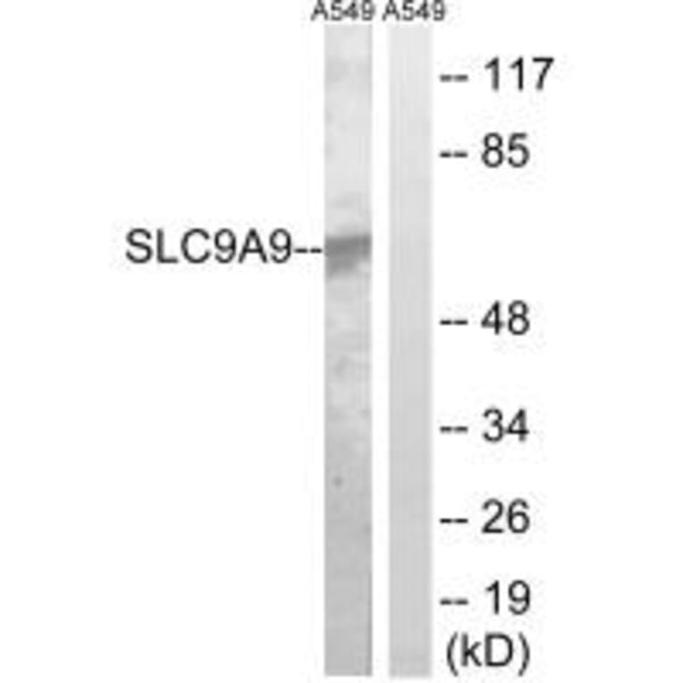 Western blot - SLC9A9 Antibody from Signalway Antibody (35060) - Antibodies.com