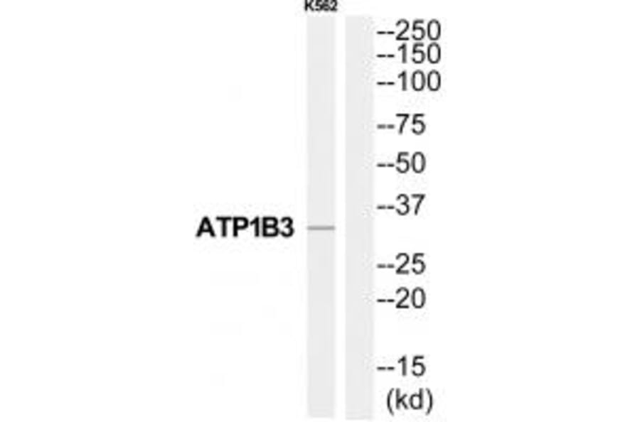 Western blot - ATP1B3 Antibody from Signalway Antibody (35063) - Antibodies.com