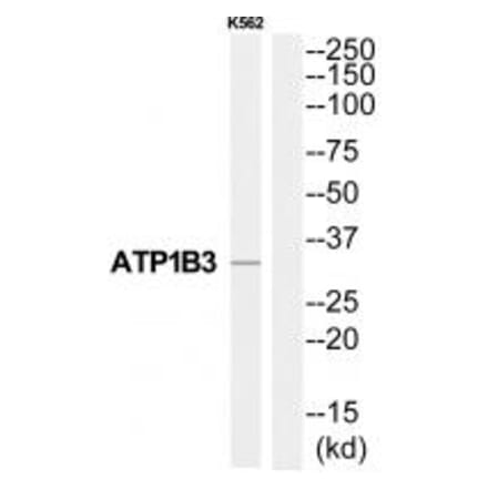 Western blot - ATP1B3 Antibody from Signalway Antibody (35063) - Antibodies.com