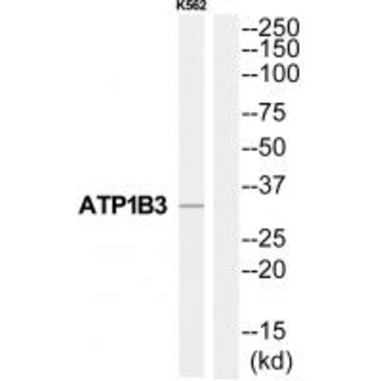 Western blot - ATP1B3 Antibody from Signalway Antibody (35063) - Antibodies.com