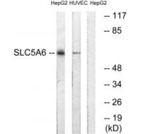 Western blot - SLC5A6 Antibody from Signalway Antibody (35064) - Antibodies.com